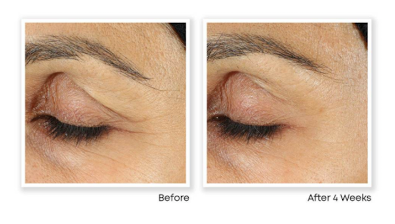 Kem Mắt RETINOL CORREXION Line Smoothing Eye Cream 6
