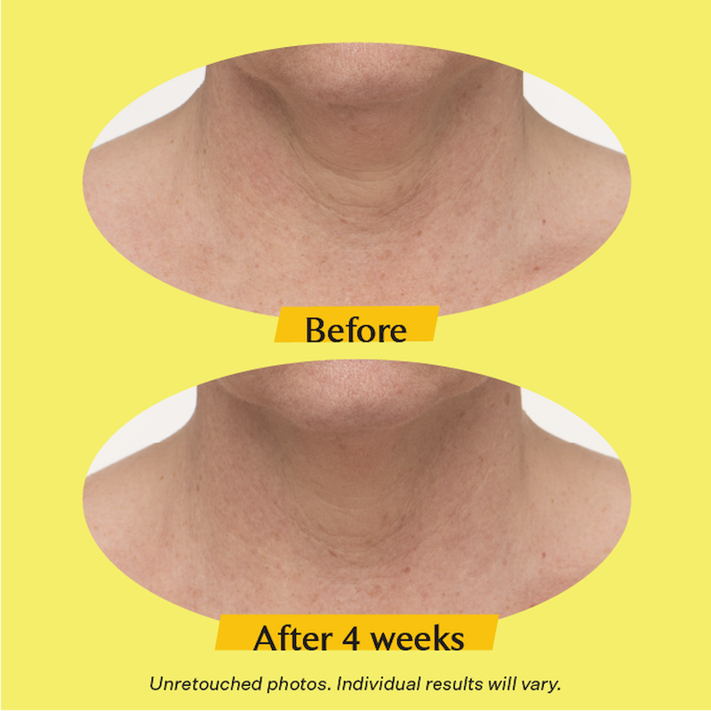 Kem Dưỡng Da Cổ StriVectin TL Advanced Tightening Neck Cream Plus 2