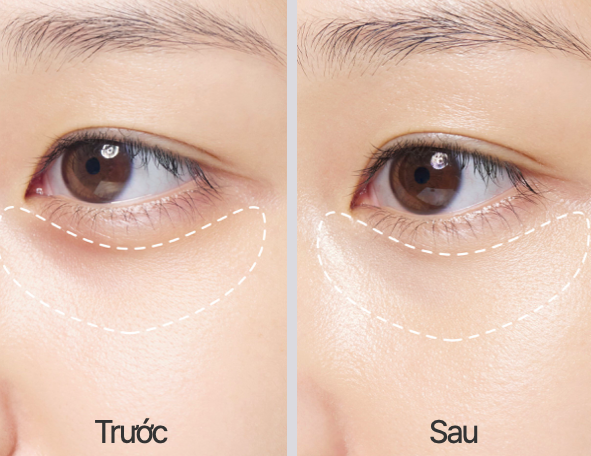 Kem Dưỡng Ẩm Vùng Mắt LANEIGE Water Bank Blue HA Eye Cream 4