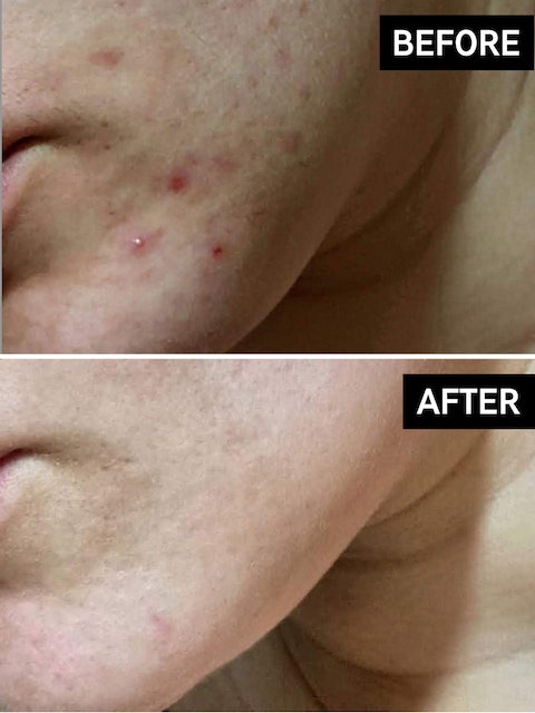 Niacinamide Serum 2