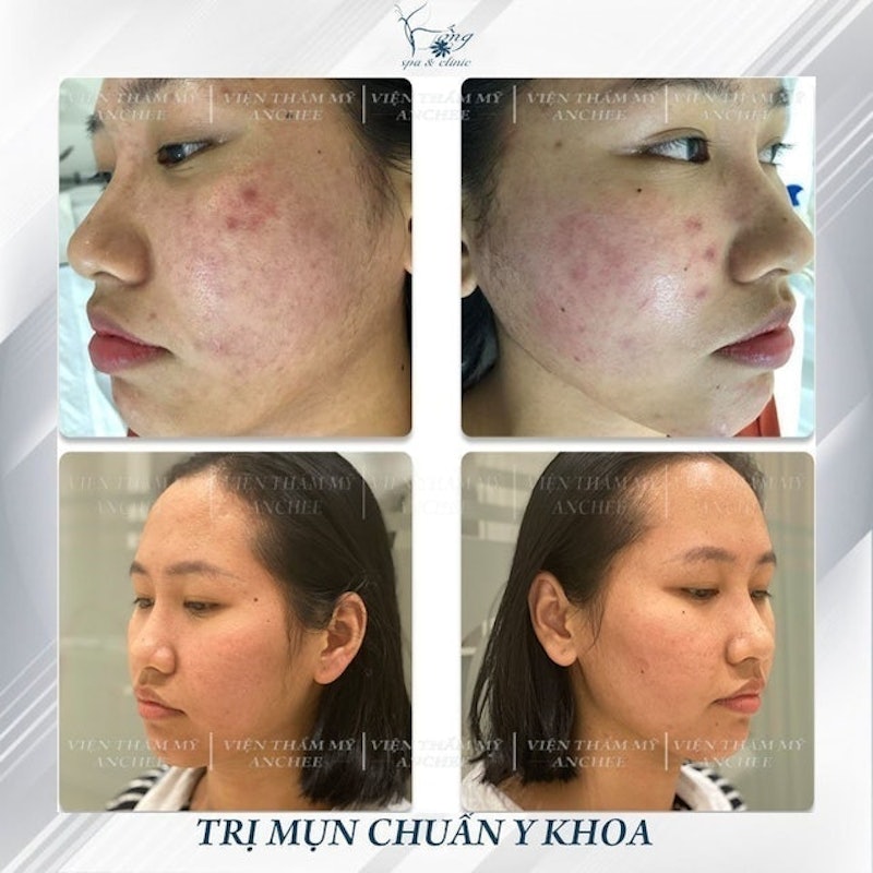 Viện Thẩm Mỹ Anchee Clinic 2