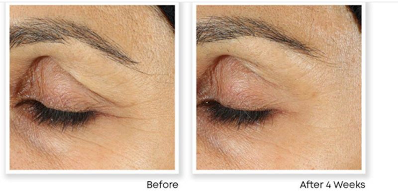 Kem Mắt Retinol Correxion 3