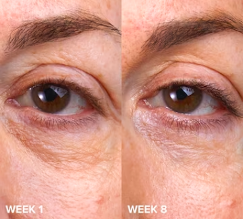 Kem Mắt Vitamin C Paula's Choice C5 Super Boost Eye Cream 4