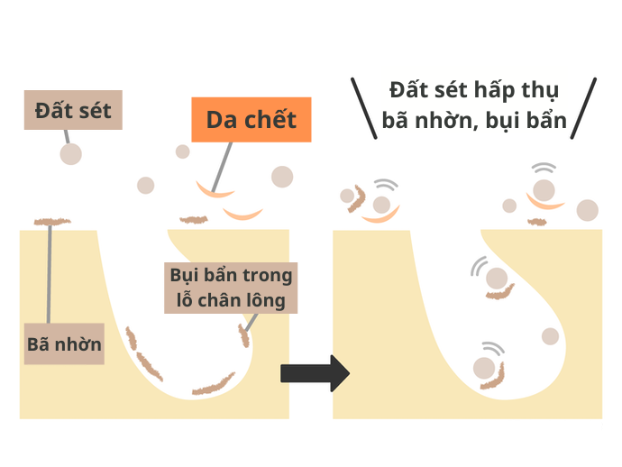 Da Dầu Mụn Không Quá Nặng: Chọn Thành Phần Như Đất Sét, Myristic Acid, Palmitic Acid, Stearic Acid, v.v.