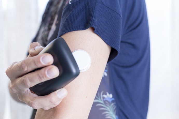 Không Cần Lấy Máu (CGM/FGM): Sử Dụng Cảm Biến Để Theo Dõi Liên Tục Và Thường Xuyên