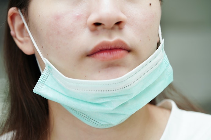 Da Mụn, Đang Điều Trị Mụn Hoặc Treatment Cân Nhắc Thêm Niacinamide. Cần Tránh Chọn Serum B5 Chứa Retinol, BHA