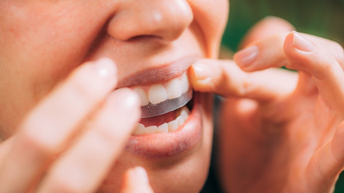 Miếng Dán: Bao Bọc Răng Kỹ Lưỡng Cho Thành Phần Thấm Sâu
